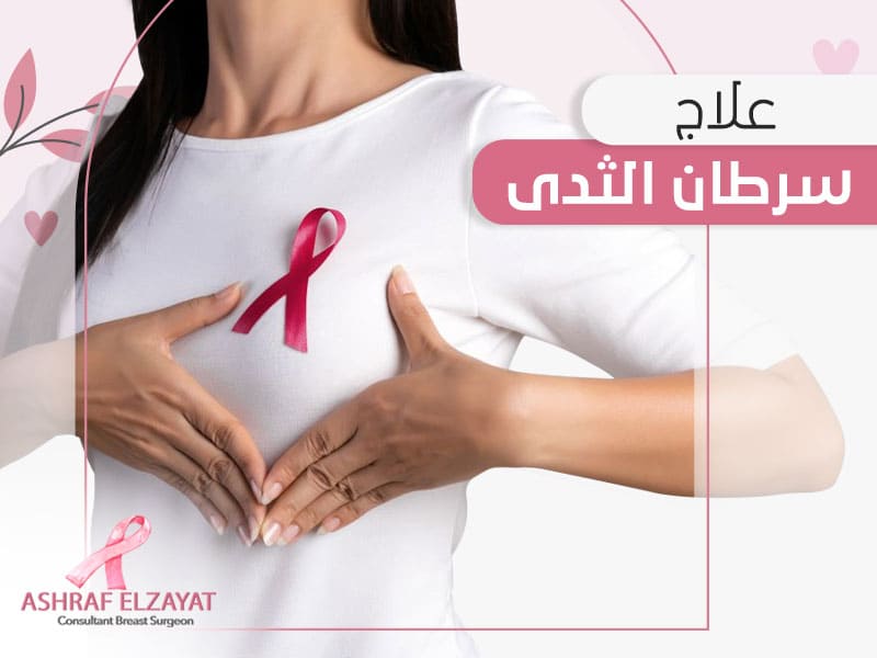 علاج سرطان الثدي - اشرف الزيات