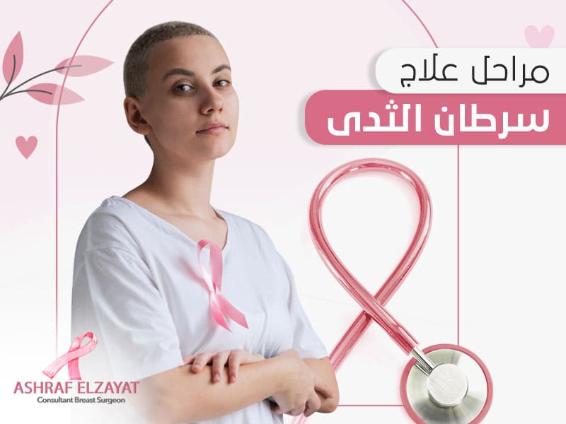 مراحل علاج سرطان الثدي - اشرف الزيات