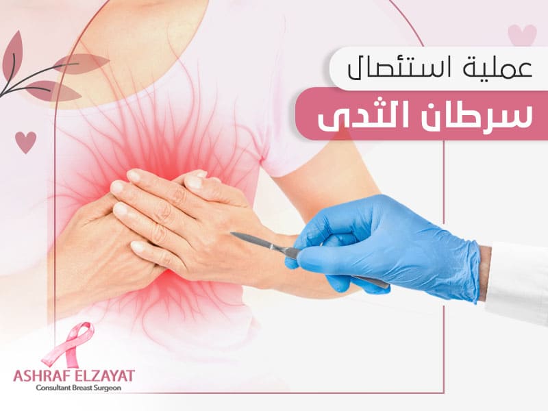 عملية استئصال سرطان الثدي - اشرف الزيات
