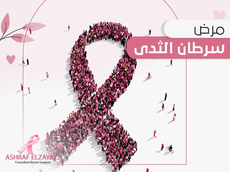 مرض سرطان الثدي - الاعراض والاسباب