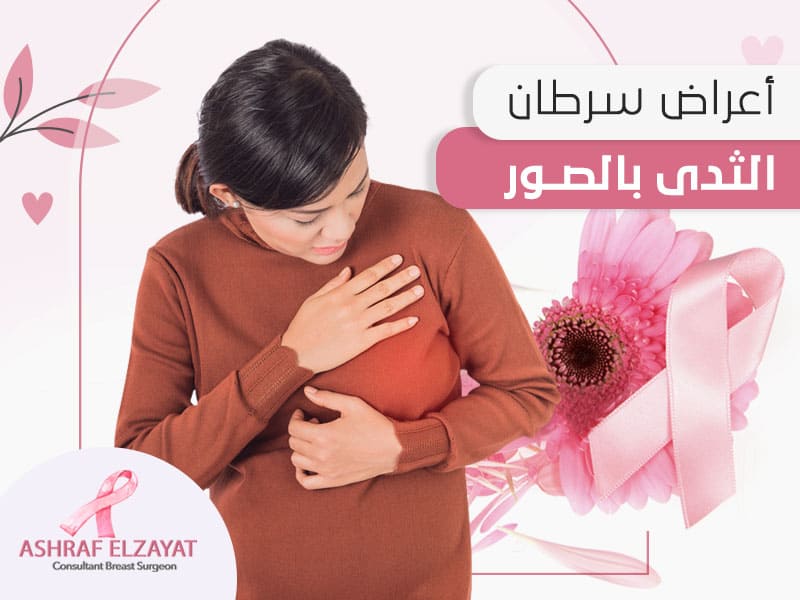 أعراض سرطان الثدي بالصور - اشرف الزيات