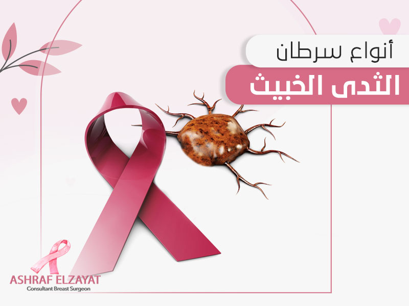 أنواع سرطان الثدي الخبيث - د اشرف الزيات